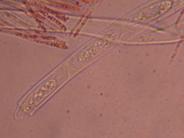 Sarcoscypha jurana... al microscopio